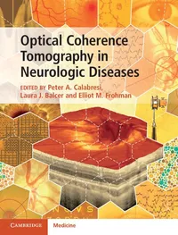 Buy OPTICAL COHERENCE TOMOGRAPHY IN NEUROLOGIC DISEASES | by Peter A. Calabresi | Laura J. Balcer | Elliot M. Frohman | Cambridge University Press | English | 1st Edition — BookShops.in