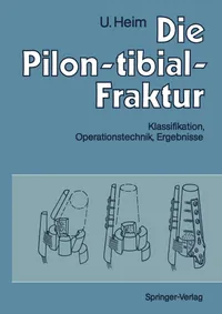 Buy Die Pilon-tibial-Fraktur: Klassifikation, Operationstechnik, Ergebnisse | by A. Gächter | Urs Heim | M. Allgöwer | Springer-Verlag Berlin and Heidelberg GmbH & Co. K | German | Softcover reprint of the original 1st ed. 1991 Edition — BookShops.in
