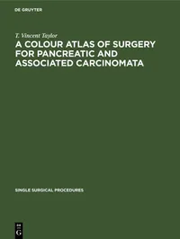 Buy A Colour Atlas of Surgery for Pancreatic and Associated Carcinomata by T. Vincent Taylor | De Gruyter | German | Paperback | Reprint 2021 — BookShops.in