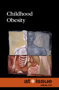 Buy Childhood Obesity (At Issue) by Tamara Thompson | Greenhaven Pr | Hardcover | Annotated Edition | Teen & Young Adult Social Issues — BookShops.in