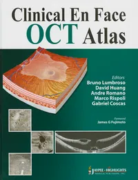 Buy Clinical En Face OCT Atlas by Bruno Lumbroso, David Huang, Andre Romano | Jaypee Brothers | Hardcover | 9789350902967 — BookShops.in