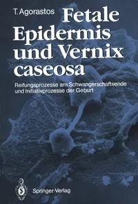 Buy Fetale Epidermis und Vernix caseosa: Reifungsprozesse am Schwangerschaftsende und Initiativprozesse der Geburt – Theodoros Agorastos – Springer-Verlag – German Hardcover – Obstetrics & Gynecology — BookShops.in