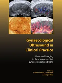 Buy Gynaecological Ultrasound in Clinical Practice: Ultrasound Imaging in Gynaecological Conditions by Davor Jurkovic, Lil Valentin, Sanjay Vyas - Royal College of Obstetricians and Gynaecologists Hardcover English 9781904752295 — BookShops.in