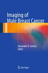 Buy Imaging of Male Breast Cancer by Alexander N. Sencha | Springer Nature | Hardcover | 1st Edition | Radiology & Nuclear Medicine Textbook — BookShops.in