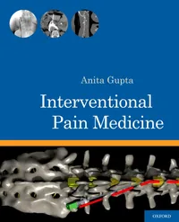 Buy Interventional Pain Medicine by Anita Gupta | Oxford Univ Pr | English | Paperback | 1st Edition | 2012 — BookShops.in