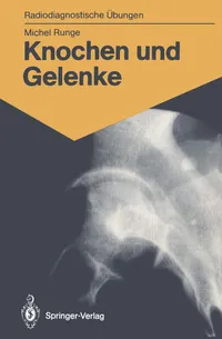 Buy Knochen und Gelenke: 170 diagnostische Übungen für Studenten und praktische Radiologen | Michel Runge | Springer-Verlag | Hardcover | German | Radiology & Diagnostic Imaging Textbook — BookShops.in
