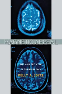 Buy Magnetic Appeal: MRI and the Myth of Transparency by Kelly Joyce | Cornell Univ Pr | Hardcover | 1st Edition | Diagnostic Imaging & Radiology Book for Medical Students & Professionals — BookShops.in