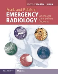 Buy Pearls and Pitfalls in Emergency Radiology by Martin L. Gunn | Cambridge University Press | English | Paperback | 1st Edition — BookShops.in