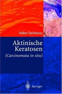Buy Aktinische Keratosen (Carcinomata in situ) by Volker Steinkraus – Springer-Verlag Hardcover 2004 German Medical Textbook — BookShops.in