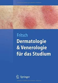 Buy Dermatologie und Venerologie für das Studium (Springer-Lehrbuch) by Peter Fritsch | Hardcover | German Edition | 2009 | Springer-Verlag — BookShops.in