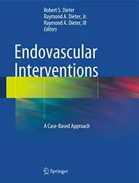 Buy Endovascular Interventions: A Case-Based Approach by Robert S. Dieter, Raymond A. Dieter Jr, Raymond A. Dieter III | Springer Nature | Hardcover | 1st Edition | Medicine & Health Sciences | Thoracic Surgery Textbook — BookShops.in