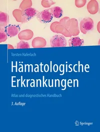 Buy Hämatologische Erkrankungen: Atlas und diagnostisches Handbuch by Torsten Haferlach | Springer | German | Paperback | 3rd Edition 2020 | Hematology Textbook — BookShops.in