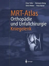 Buy MRT-Atlas Orthopädie und Unfallchirurgie: Kniegelenk by Peter Teller | Springer | German Hardcover | Radiology & Orthopedics Reference — BookShops.in