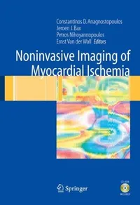 Buy Noninvasive Imaging of Myocardial Ischemia: A Guide by Anagnostopoulos, Nihoyannopoulos, Bax | Springer Verlag | Hardcover | 2006 Edition | Medicine & Health Sciences — BookShops.in