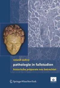 Buy Pathologie in Fallstudien: Historische Präparate neu betrachtet by T. Kolomaznik, Roland Sedivy, A. Uhl – Springer Verlag, German Hardcover, 2007 Edition, Pathology Textbook — BookShops.in