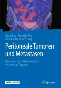 Buy Peritoneale Tumoren und Metastasen: Operative, intraperitoneale und systemische Therapie by Beate Rau | Springer | German Hardcover | 1st Edition 2018 — BookShops.in