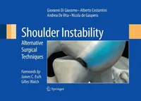 Buy Shoulder Instability: Alternative Surgical Techniques by Giovanni Di Giacomo | Springer Nature | Hardcover | Orthopedics Textbook — BookShops.in
