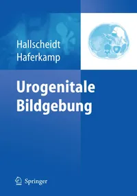 Buy Urogenitale Bildgebung by Peter Hallscheidt and Axel Haferkamp | Springer-Verlag | German Language Hardcover | 2011 Edition | Diagnostic Imaging Textbook — BookShops.in