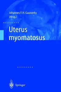 Buy Uterus Myomatosus by Johannes F. H. Gauwerky | Springer-Verlag | German Language Medical Textbook | Hardcover | Softcover Reprint 2003 Edition — BookShops.in