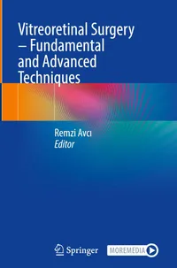 Buy Vitreoretinal Surgery: Fundamental and Advanced Techniques by Remzi Avcı | Springer | English | Paperback | 9783031875755 — BookShops.in