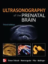 Buy Ultrasonography of the Prenatal Brain (English, Ilan Timor-Tritsch | Ana Monteagudo | Gianluigi Pilu) — BookShops.in