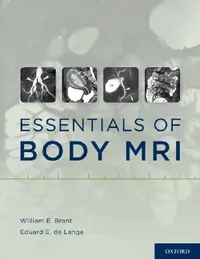 Buy Essentials of Body MRI (English, William E. Brant | Eduard E. de Lange) — BookShops.in