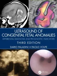 Buy Ultrasound of Congenital Fetal Anomalies (English, Paladini Dario | Paolo Volpe) — BookShops.in