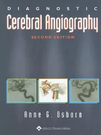 Buy Diagnostic Cerebral Angiography by Anne G. Osborn | 2nd Edition | Lippincott Williams & Wilkins | Hardcover | Medicine & Health Sciences | Neurosurgery Textbook — BookShops.in