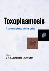 Buy Toxoplasmosis (English, David H. M. Joynson | Tim G. Wreghitt) — BookShops.in