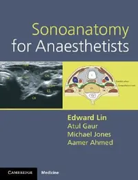 Buy Sonoanatomy for Anaesthetists (English, Edward Lin | Atul Gaur | Michael Jones) — BookShops.in