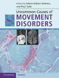 Buy Uncommon Causes of Movement Disorders (English, Néstor Gálvez-Jiménez | Paul Tuite) — BookShops.in