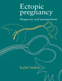 Buy Ectopic Pregnancy (English, Isabel Stabile) — BookShops.in