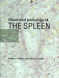 Buy Illustrated Pathology of the Spleen (English, Bridget S. Wilkins | Dennis H. Wright) — BookShops.in