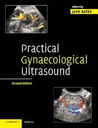 Buy Practical Gynaecological Ultrasound (English, Jane Bates) — BookShops.in
