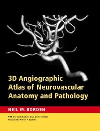 Buy 3D Angiographic Atlas of Neurovascular Anatomy and Pathology (English, Neil M. Borden) — BookShops.in