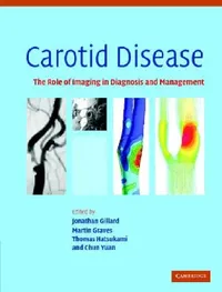 Buy Carotid Disease (English, Jonathan Gillard | Martin Graves | Thomas Hatsukami) — BookShops.in