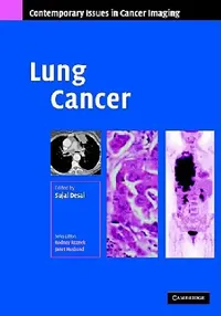 Buy Lung Cancer (English, Sujal R. Desai) — BookShops.in