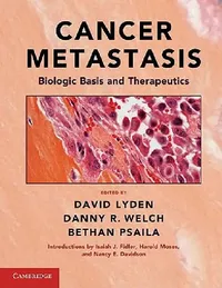 Buy Cancer Metastasis (English, David Lyden | Danny R. Welch | Bethan Psaila) — BookShops.in