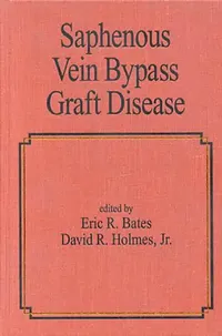 Buy Saphenous Vein Bypass Graft Disease (English, Eric R. Bates) — BookShops.in