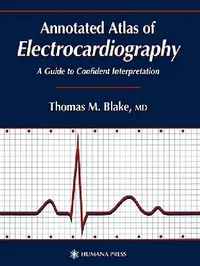 Buy Annotated Atlas of Electrocardiography (English, Thomas M. Blake) — BookShops.in