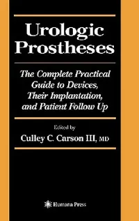 Buy Urologic Prostheses (English, Culley C. III Carson) — BookShops.in