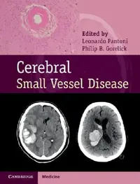 Buy Cerebral Small Vessel Disease | by Leonardo Pantoni | Philip B. Gorelick | ‎ Cambridge University Press | ‎ English | ‎ 1st Edition — BookShops.in