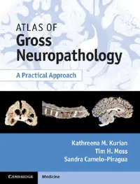 Buy Atlas of Gross Neuropathology Book and Online Bundle (English, Kathreena M. Kurian | Tim H. Moss | Sandra Camelo-Piragua) — BookShops.in