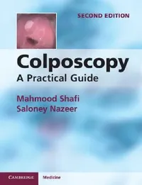 Buy Colposcopy (English, Mahmood Shafi | Saloney Nazeer) — BookShops.in