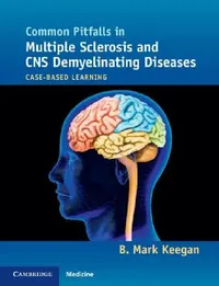 Buy Common Pitfalls in Multiple Sclerosis and CNS Demyelinating Diseases (English, B. Mark Keegan) — BookShops.in