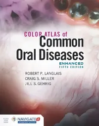Buy Color Atlas of Common Oral Diseases, Enhanced Edition | by Robert P. Langlais | Craig S. Miller | Jill S. Gehrig | Jones &amp; Bartlett Publishers | by Robert P. Langlais | Craig S. Miller | Jill S. Gehrig | Jones &amp; Bartlett Publishers | by Robert P. Langlais | Craig S. Miller | Jill S. Gehrig | Jones &amp; Bartlett Publishers | by Robert P. Langlais | Craig S. Miller | Jill S. Gehrig | Jones &amp; Bartlett Publishers | by Robert P. Langlais | Craig S. Miller | Jill S. Gehrig | Jones &amp; B — BookShops.in
