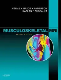 Buy Musculoskeletal MRI (English, Clyde A. Helms | Nancy M. Major | Mark W. Anderson) — BookShops.in