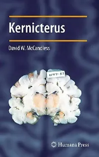 Buy Kernicterus (English, David W. McCandless) — BookShops.in