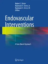 Buy Endovascular Interventions (English, Robert S. Dieter | Raymond A. Dieter Jr | Raymond A. Dieter III) — BookShops.in