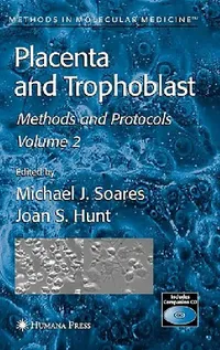 Buy Placenta and Trophoblast (English, Michael J. Soares | Joan S. Hunt) — BookShops.in